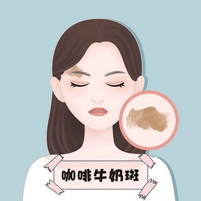 咖啡斑疾病可能会影响孩子的日常学习！