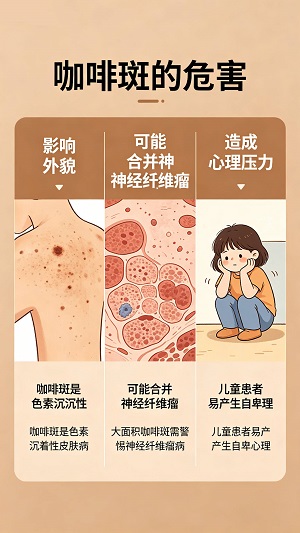 咖啡斑会随着年龄的增长而长大吗？南京胎记专科医院哪家好？
